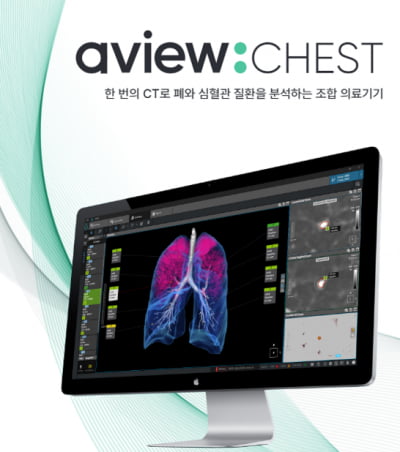 코어라인소프트, 내달 KCR 2024 참가…흉부 전문 솔루션 시연